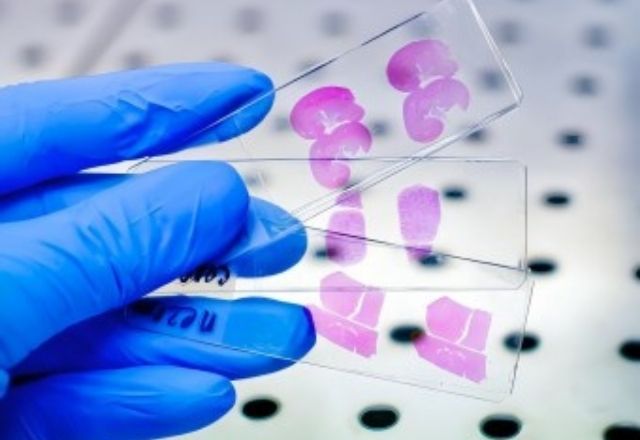 Untargeted Metabolomics