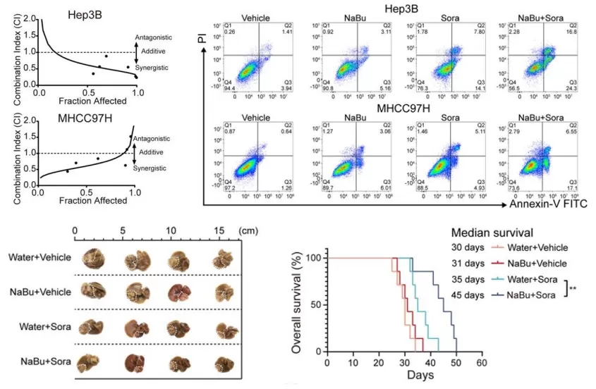 Combined sodium butyrate and sorafenib therapy suppresses HCC progression via apoptosis induction, tumor volume reduction, and improved survival in mouse models – Hepatology 2023.