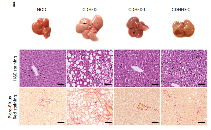 Inulin_ameliorates_NASH_in_two_mouse_models_of_disease